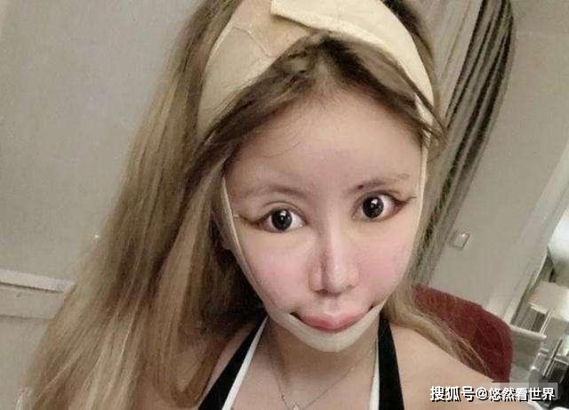 知名网红13岁开始,已整容100多次,称已获得赖冠霖公司面试邀请_娜娜