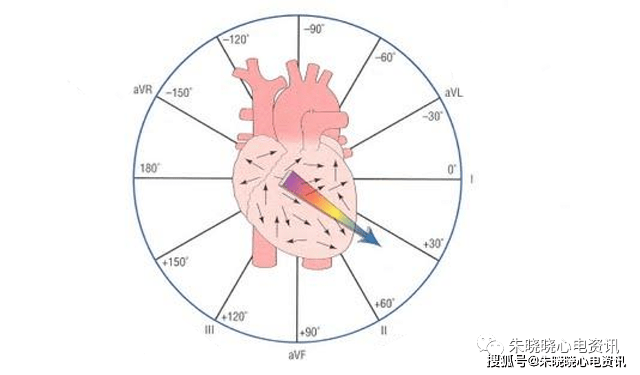 心电图横面六轴系统图片