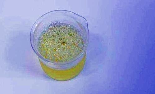 告诉你正常的标准_尿液