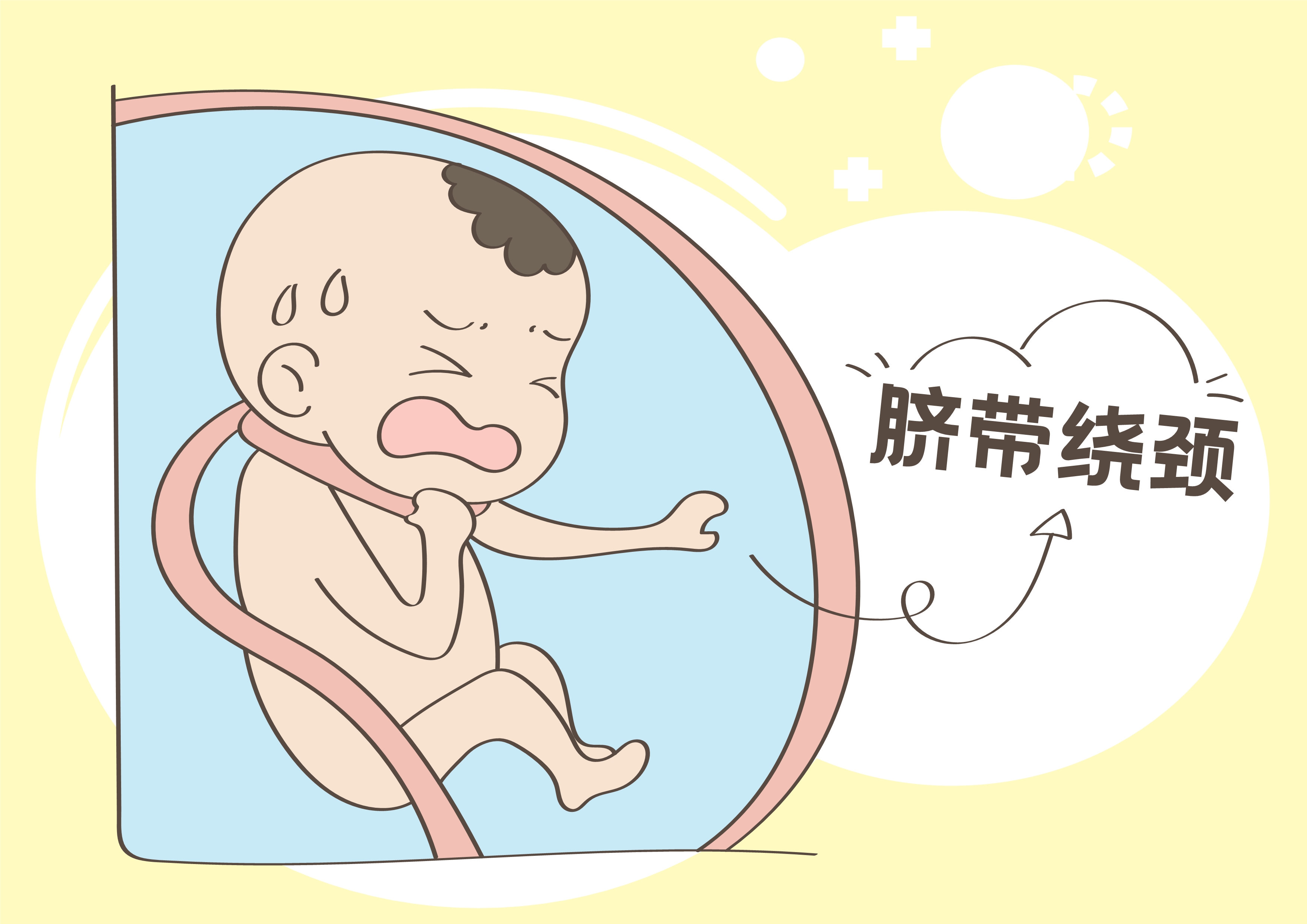 宝宝脐带绕颈大部分来源于孕妈的坏习惯赶紧改正吧