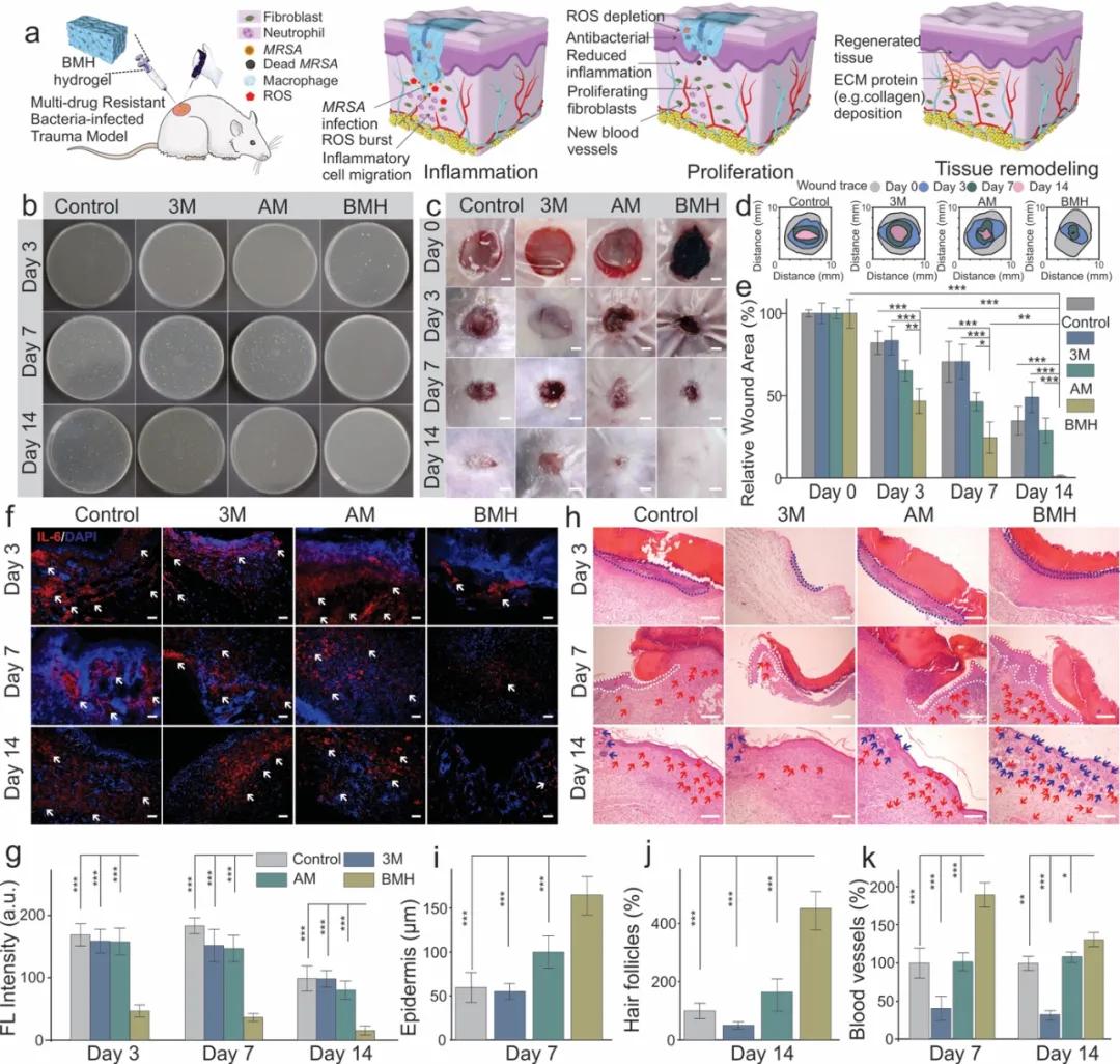 多响应MnO2复合水凝胶用于同时治疗黑色素瘤和耐药菌感染皮肤损伤修复-搜狐大视野-搜狐新闻