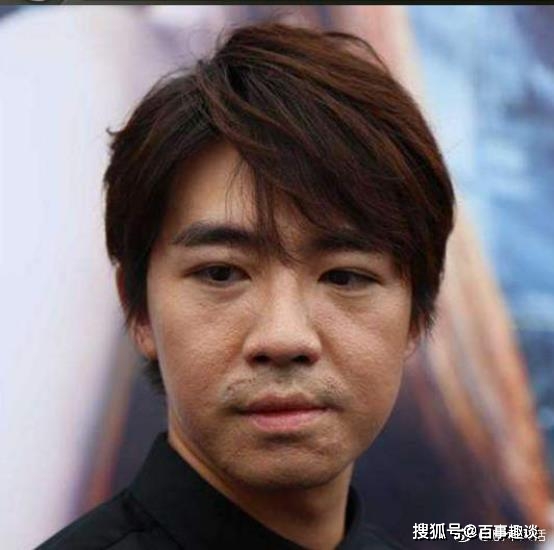 为《八佰》"献身"的俞灏明,露出当年被烧伤的疤痕,涅盘重生