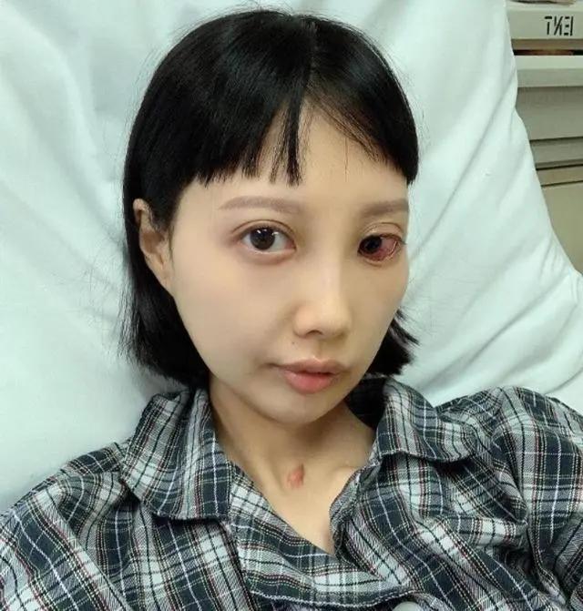 痛心!香港女歌手抗癌8年,癌变扩散右眼失明,今弃治疗等待死亡
