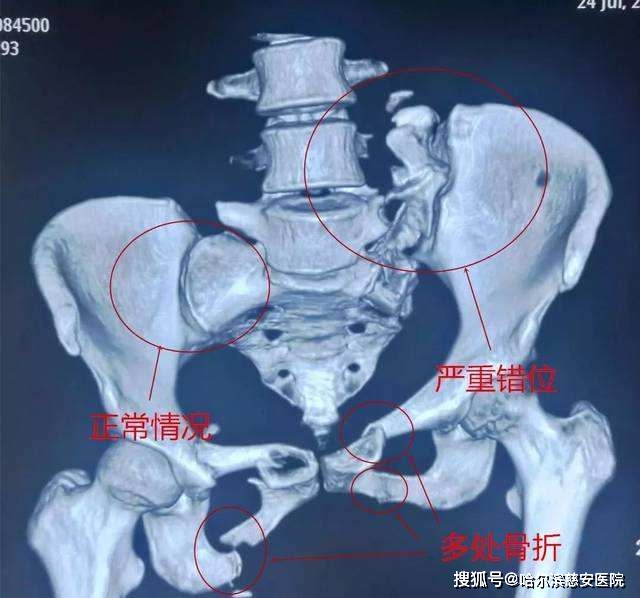 哈尔滨慈安医院 (1)