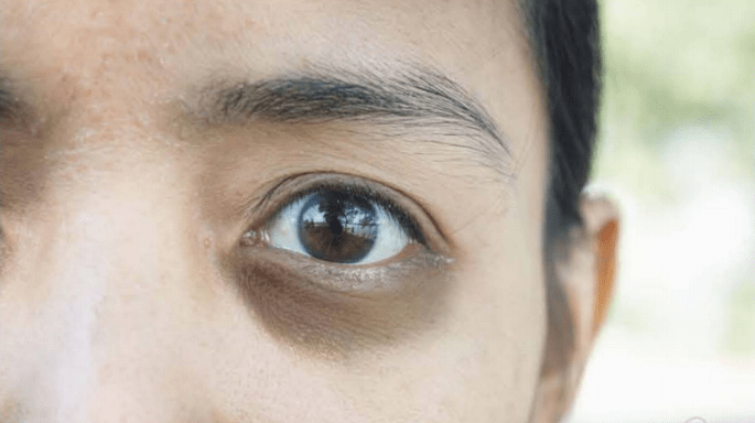 长期熬夜的皮肤护理方法:基本保湿 美白抗氧化精华