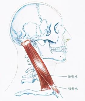 脖子紧还头疼?拿出1分钟,1个动作拉伸胸锁乳突肌,尴尬但有效