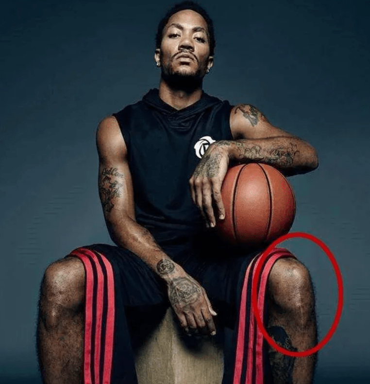 詹姆斯眼睛险失明,奥尼尔脚趾严重变形!_科比