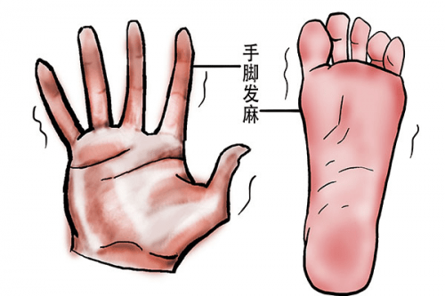 2. 當左腳麻時抬起右胳膊,右腳麻時抬起左胳膊.3.