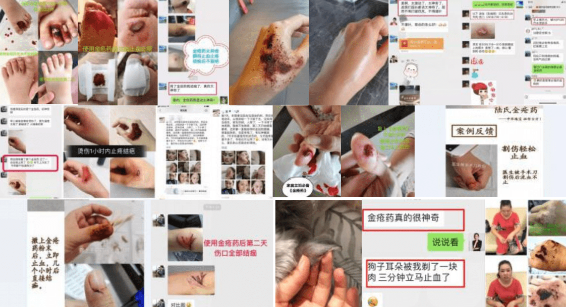 听说郎中堂金疮药祖传配方一敷就好是真的吗