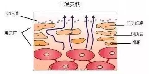 你们关心的毛孔粗大问题,怎么破?_皮肤
