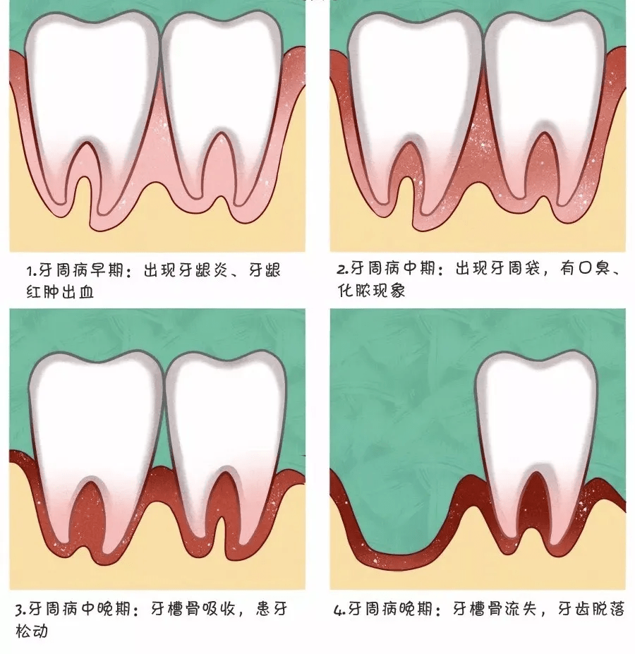 不想