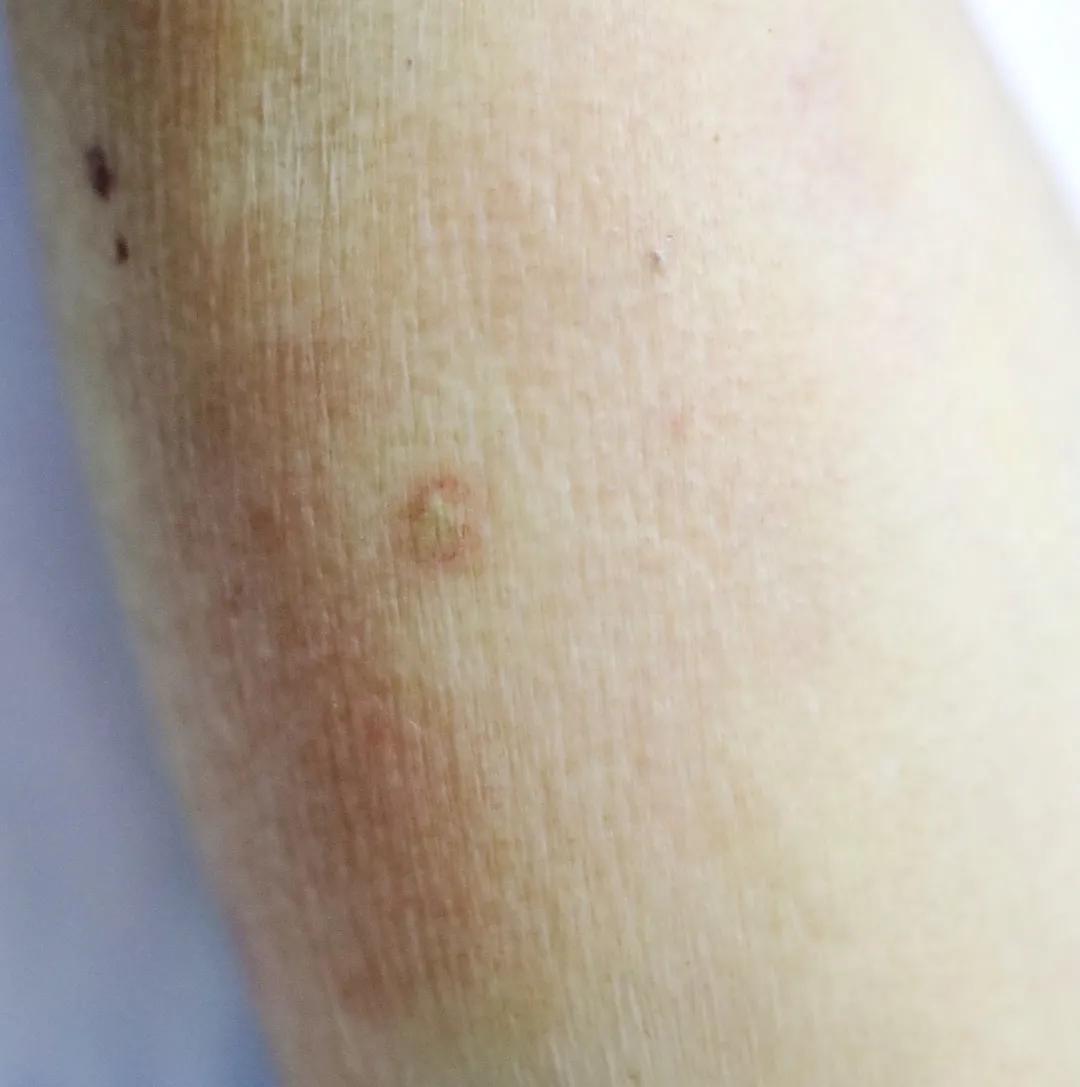 茂名这里一百多人被蜂蜇伤,拜山要注意啦!_手机搜狐网