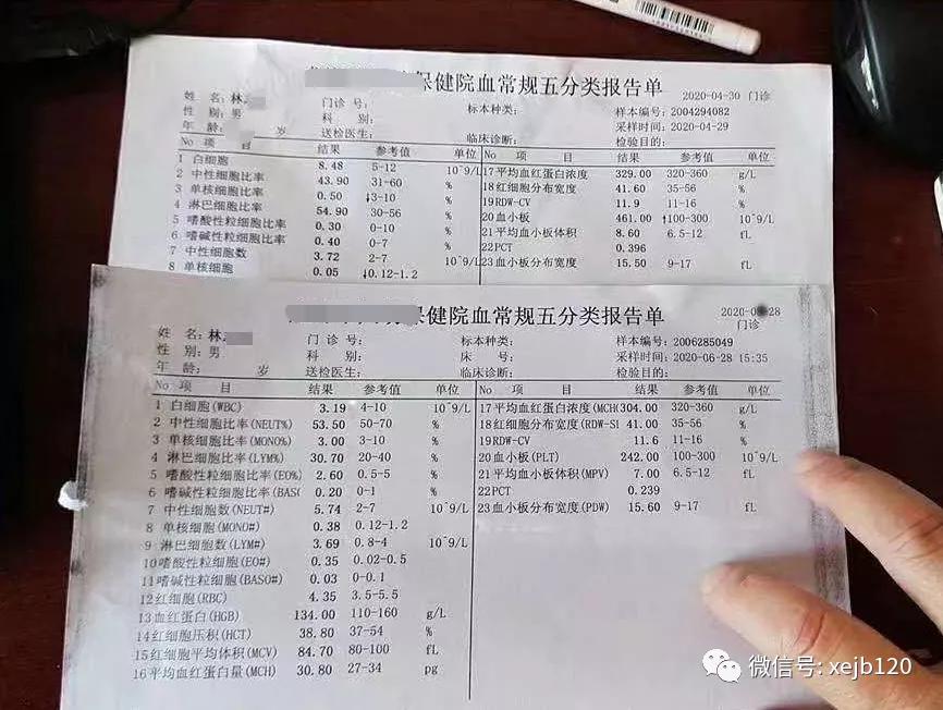 【血小板增多症病友分享】兩月後數值穩定242!