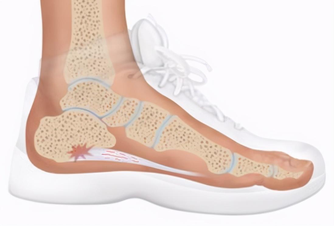 1. ラベンダーエッセンシャルオイルを塗る