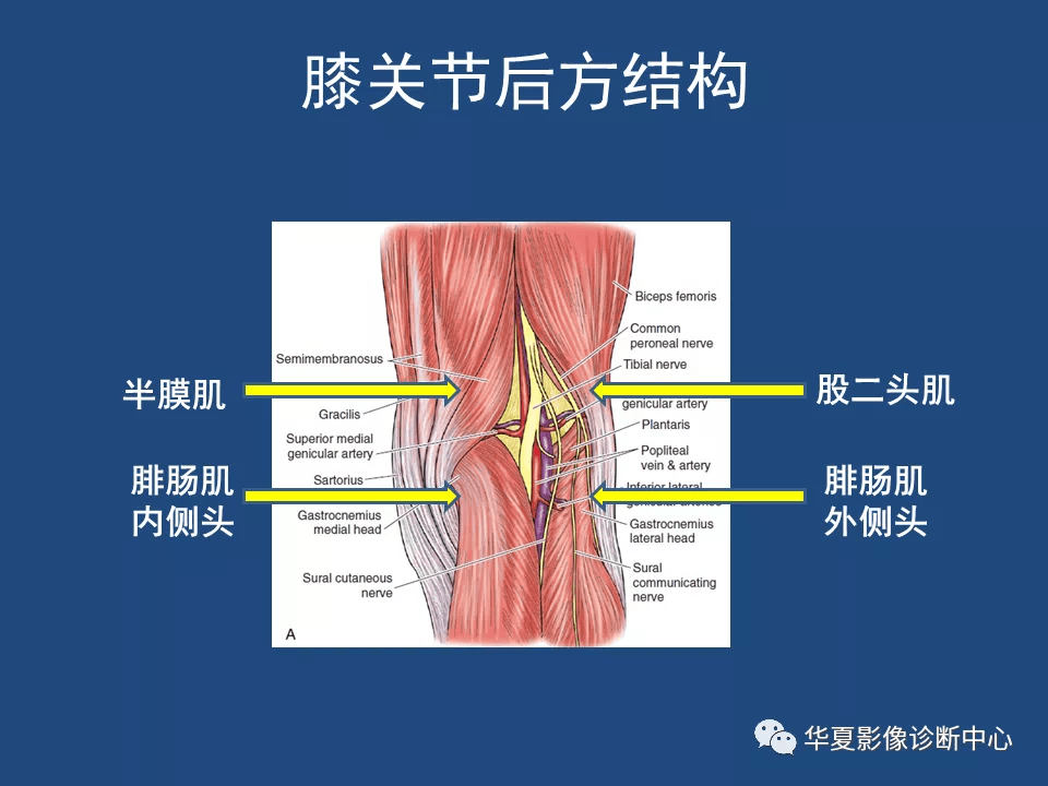 膝關節解剖詳細圖解