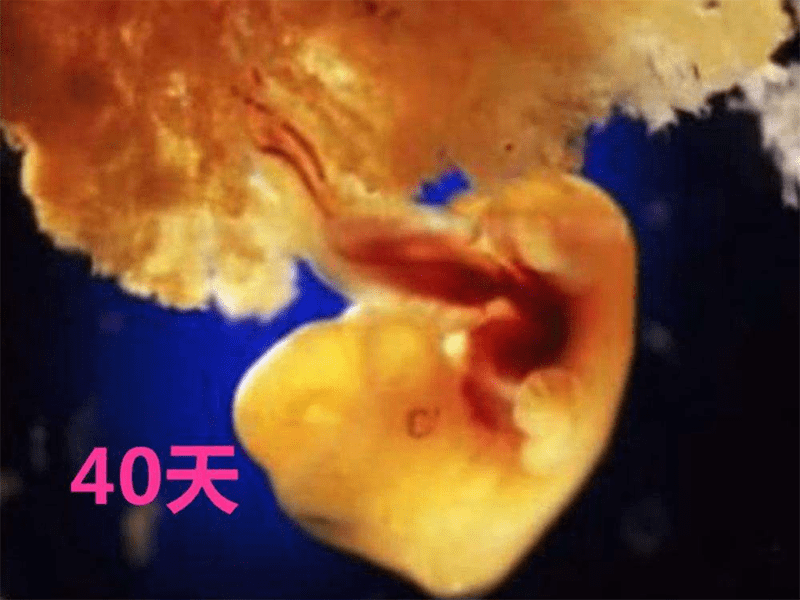 胎儿40天的样子图片图片