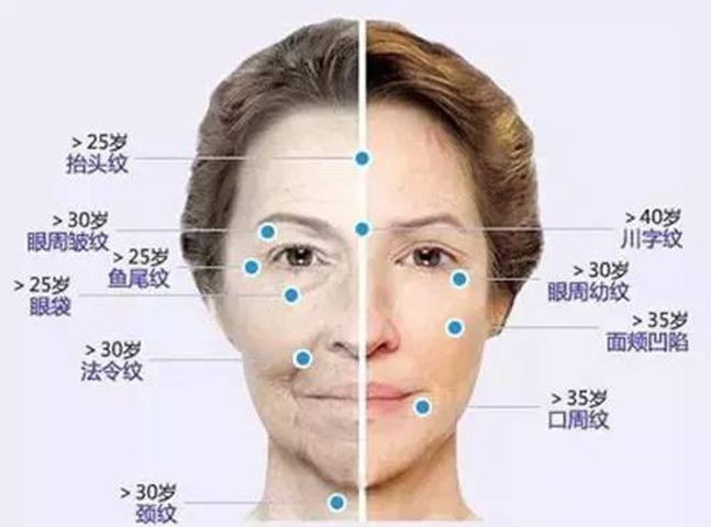 如何终结面部皱纹问题,smas深层提升能解决吗?卢九宁院长来解答