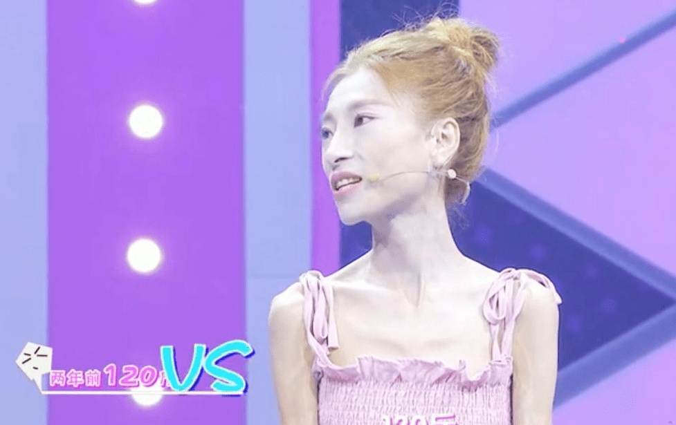 太胖不好看太瘦就好看了?她身高167体重58斤,网友:健康去哪了