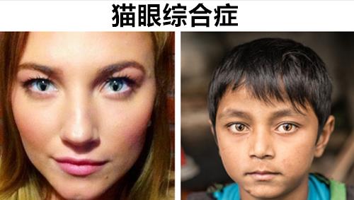 原创真实存在于世上拥有8种极其罕见眼睛颜色的人类