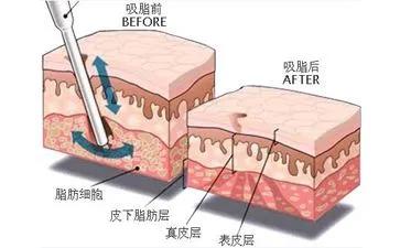 知识科普|医美到底疼不疼？爱美的女人必须要知道