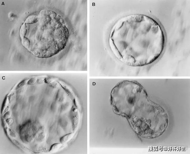 试管婴儿疗程中怎样判断囊胚的等级?_手机搜狐网