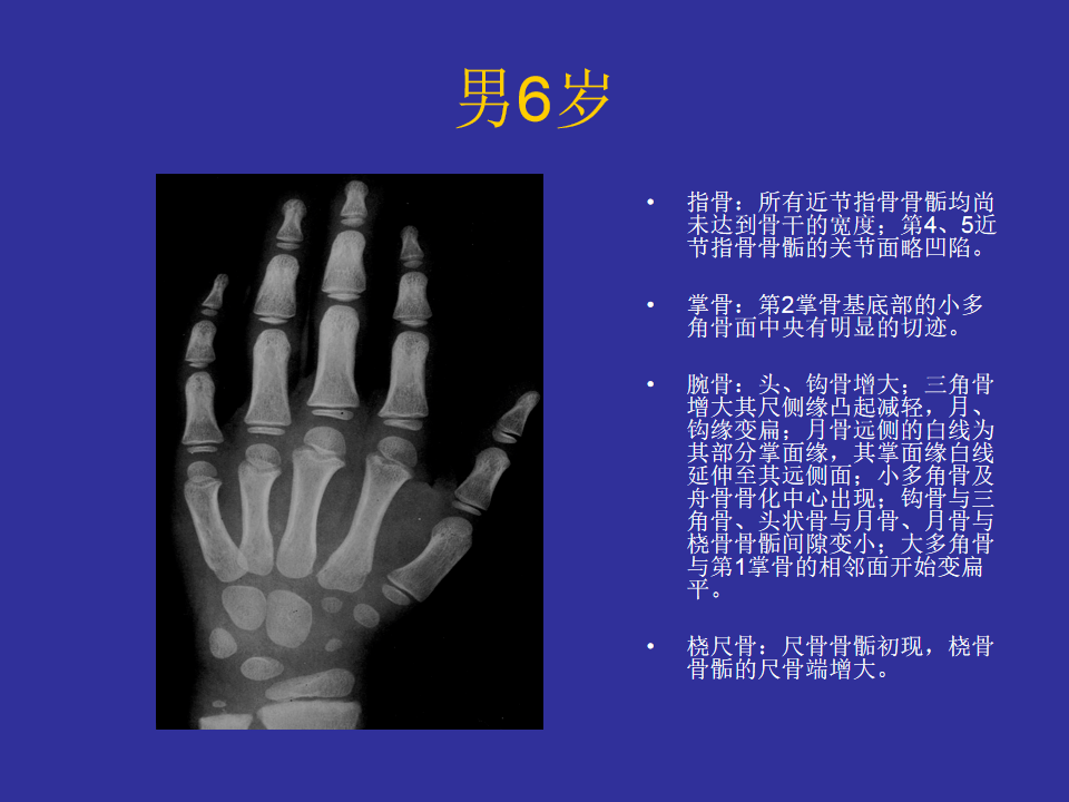 男性骨龄读片指南