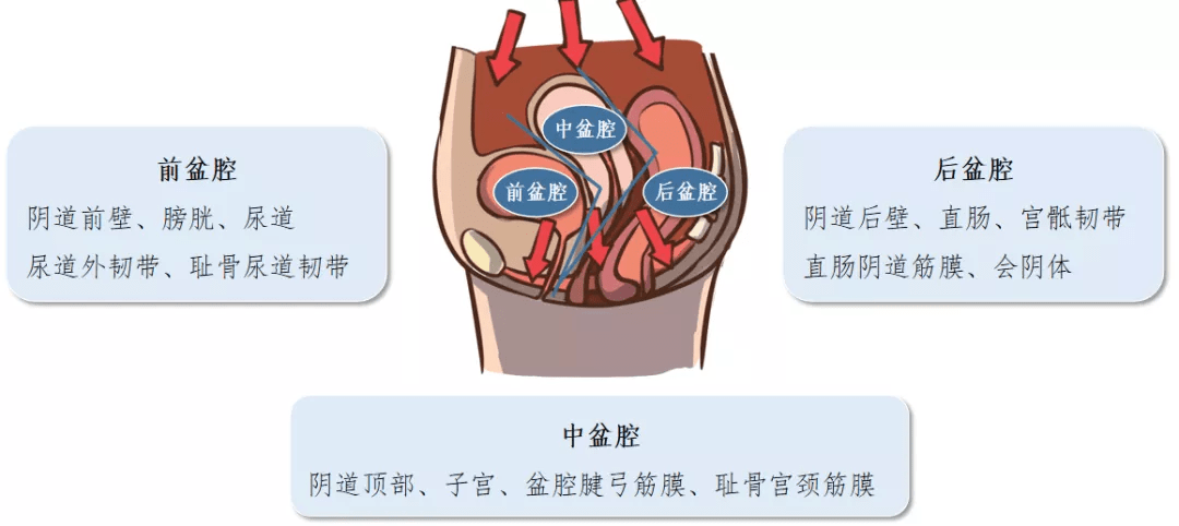 盆底:我太难了!_手机搜狐网
