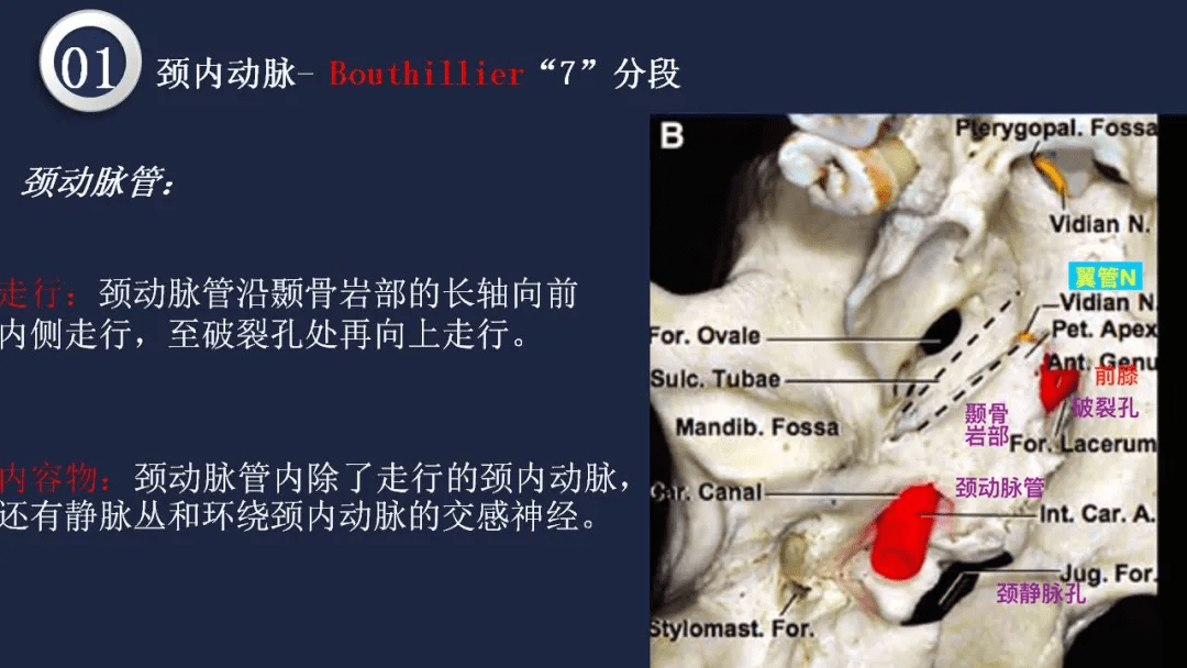 高清頭頸動脈系統解剖