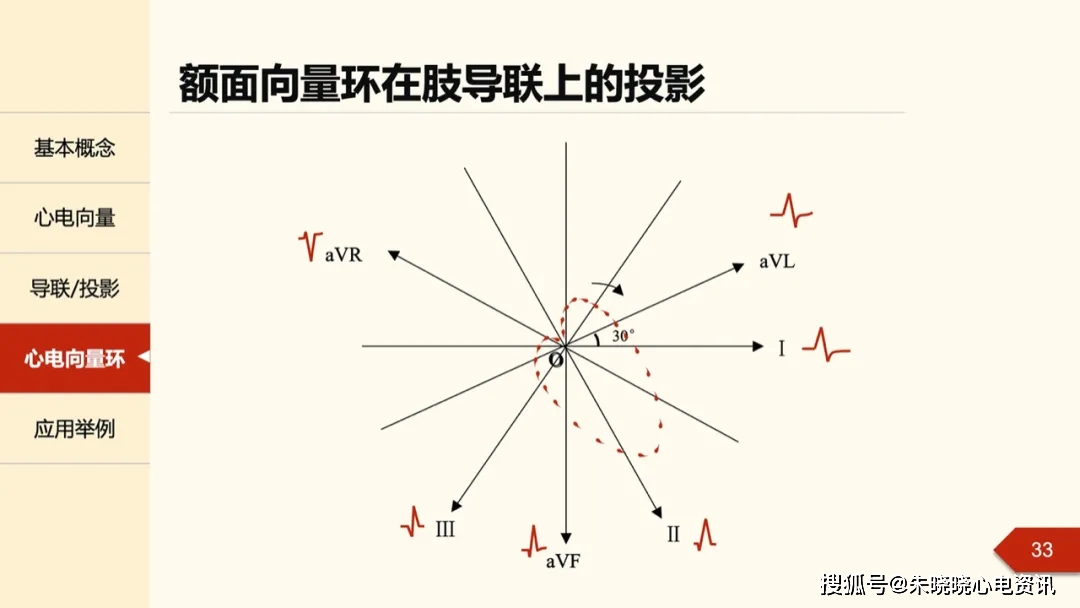 一文掌握心电向量:从基本原理到临床应用