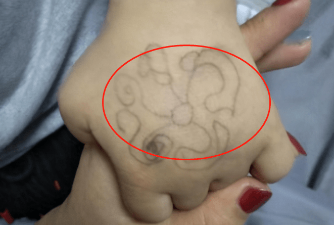 "老师"在孩子手背画画,女儿回家给父母看,爸爸偷偷回房间报警