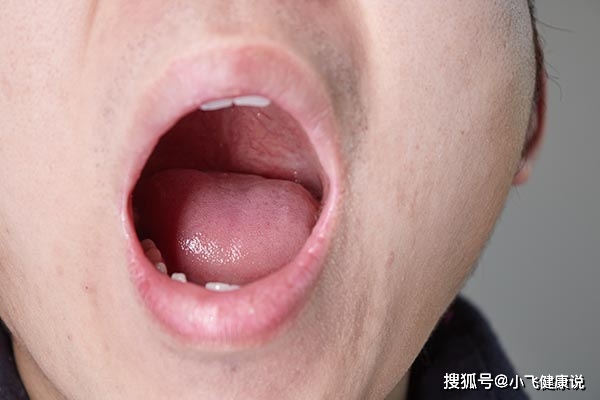 原創看舌頭知健康舌頭有4變小心疾病纏上身需多加留意