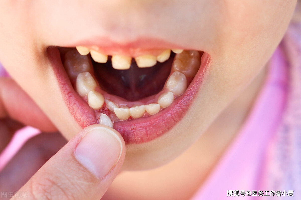 儿童牙周炎的症状图片图片