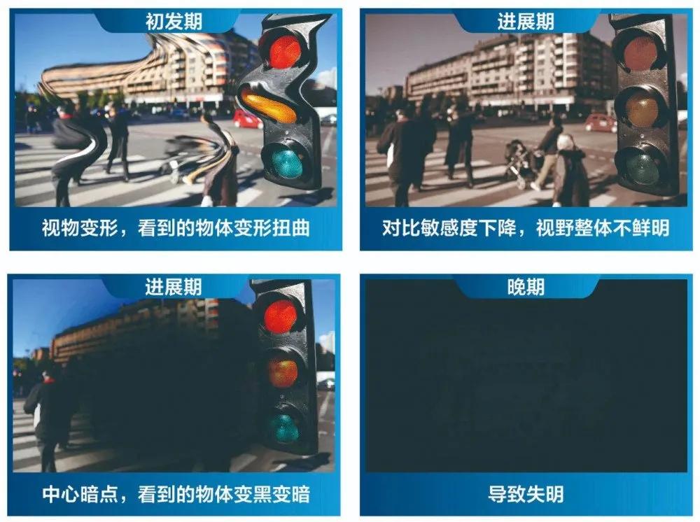 老年性|你知道吗？这几类人需定期给眼睛“体检”