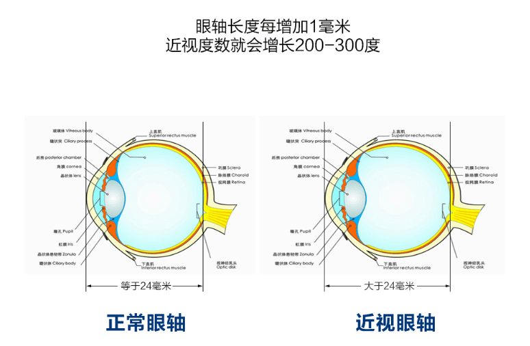 人均近视度数_近视度数对照表