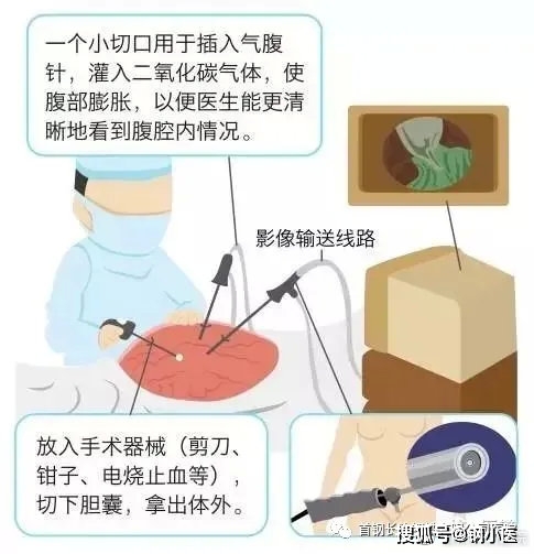 怎么样看心肺功能 27aa0c0cca0b4ccf8173a1f4ab288fa7.jpeg
