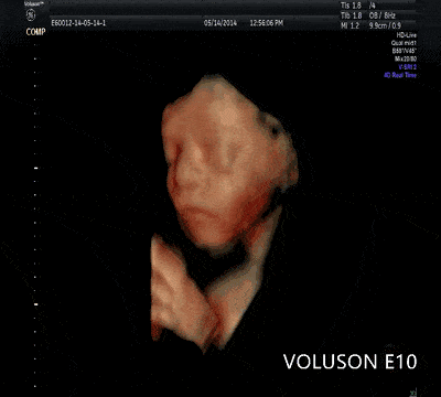 2b60c19ab8204524988516adbbf97084.gif