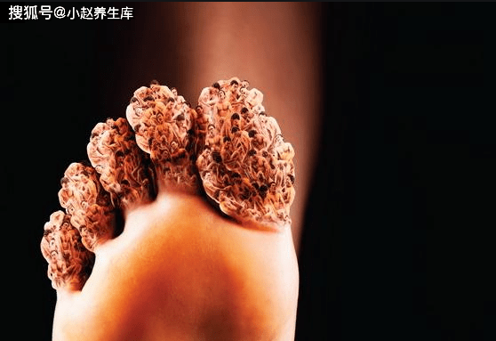 什么食物升尿酸快 66456cffaaff41d693781c08ed2e666c.png