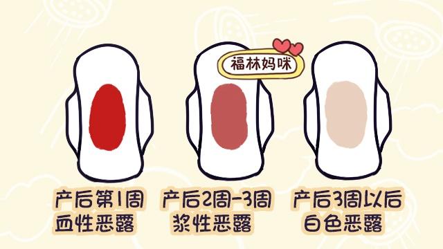 产后恶露排不净 多是这4个原因,产后做到这5点恶露尽早排干净