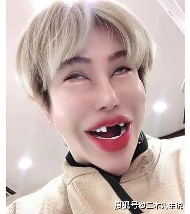 日本帅小伙靠富婆金主扶持整容花了一个亿却变成了青蛙脸