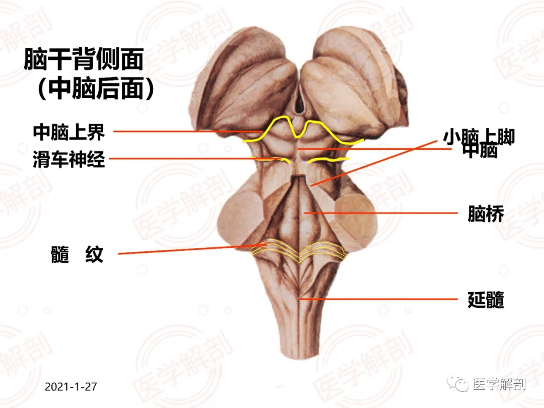 脑干解剖及相关临床综合征