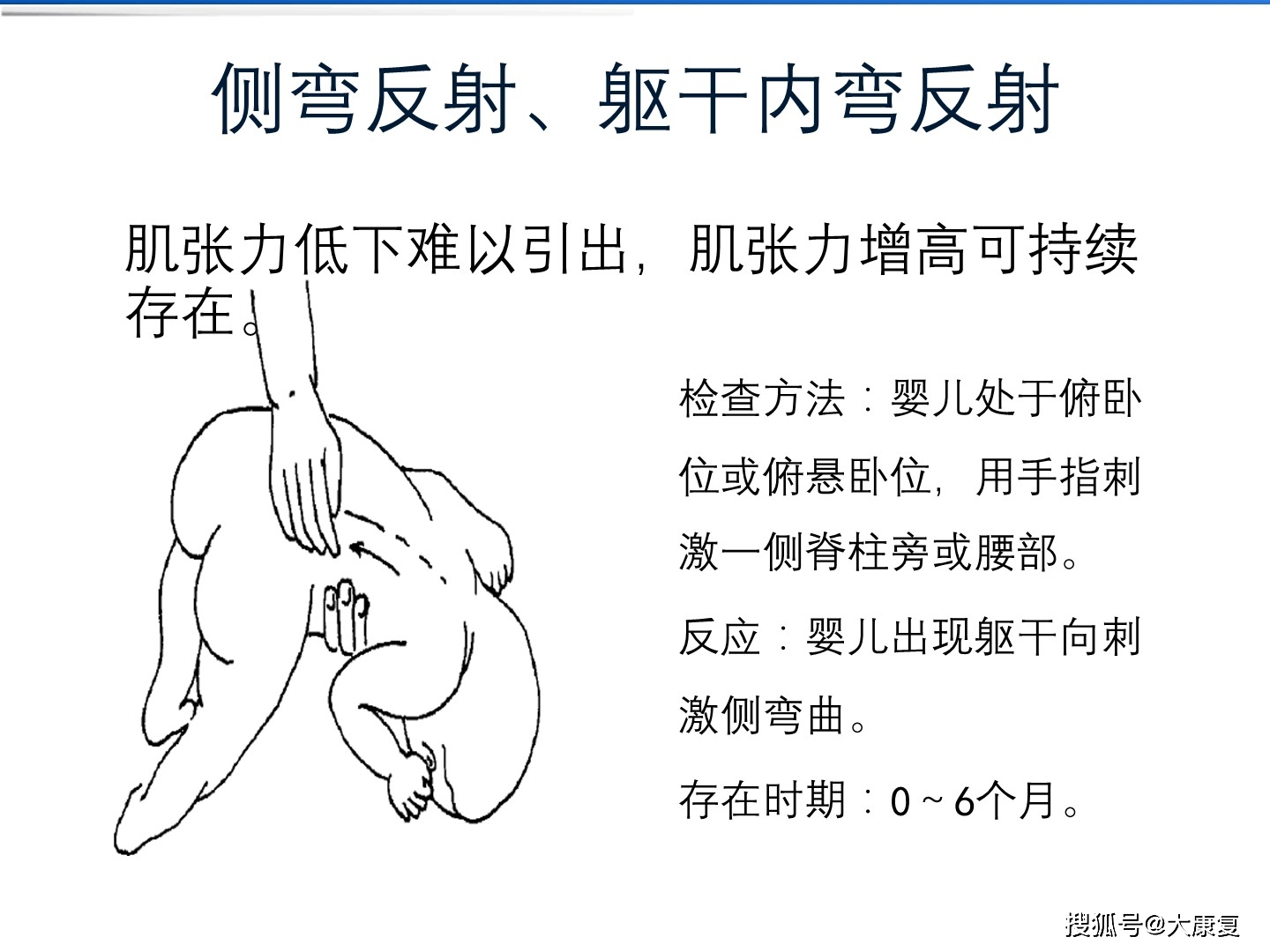 脑性瘫痪康复评定