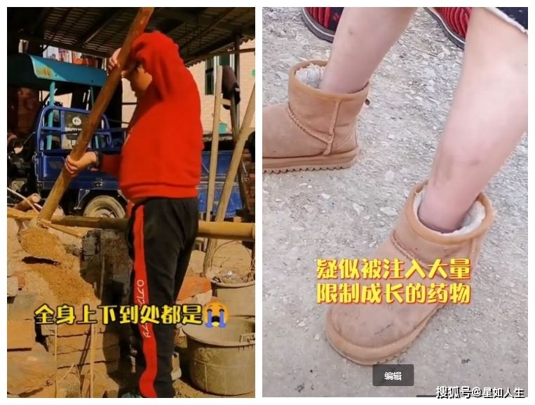 直击网红小马云真实近况全身是伤疑被强制打针至今仍不识数