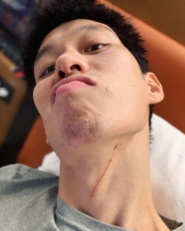 5分惜败!为了阻止林书豪得分,脖子都被抓伤了,赛后一句话获赞