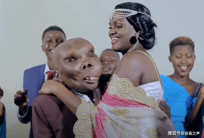 "世界最丑男"遭母抛弃,被戴绿帽他反转人生当歌星娶娇妻