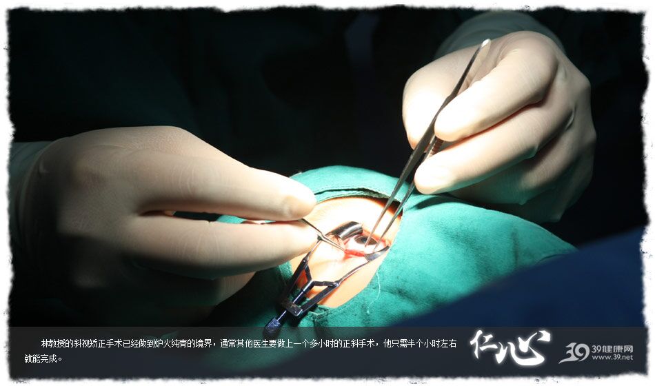 斜视与弱视的诊治以及眼的显微外科手术,由他做的矫正斜视手术已经到