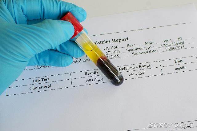 怎么做才能降血糖血脂 1518858239e6412cb61b973d47f39d26.jpeg