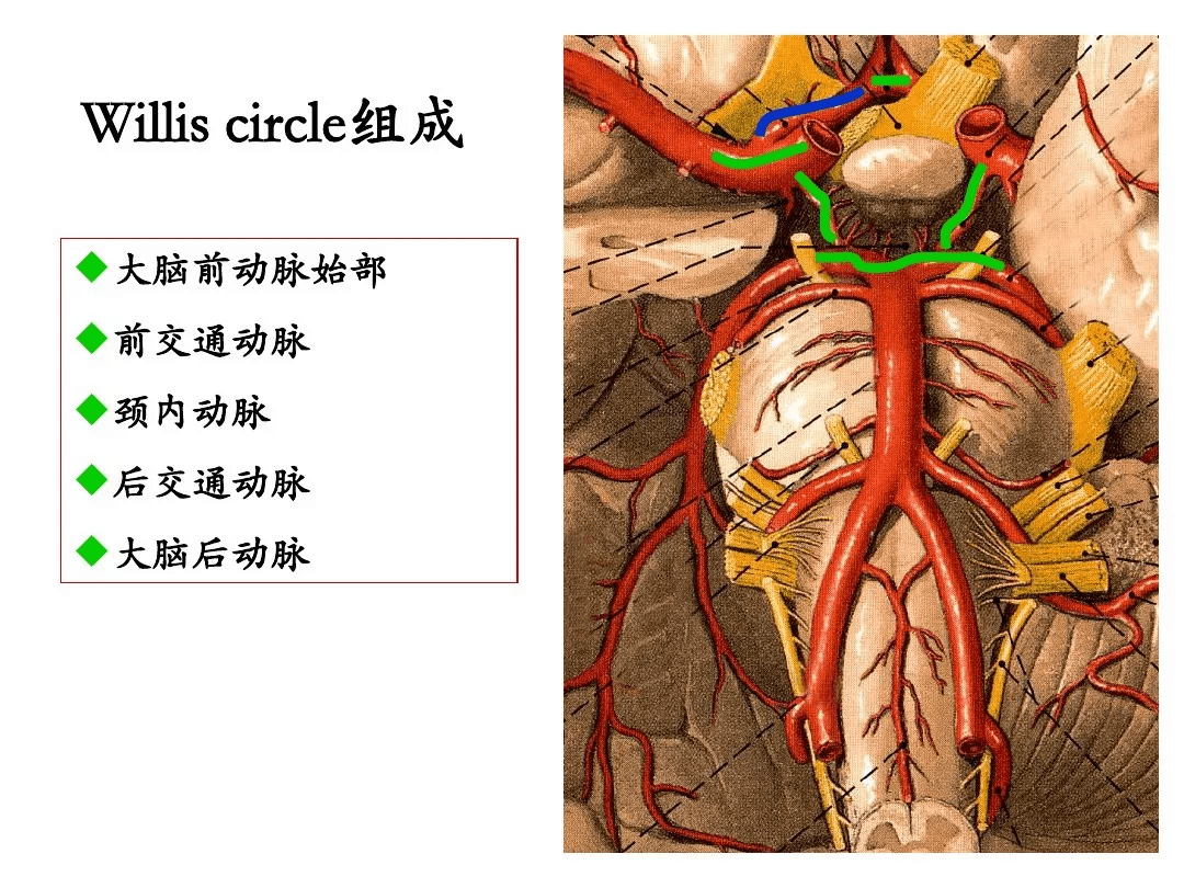 4:大脑动脉环(willis环)3:椎—基底动脉系统2:颈内动脉系统1:脑血管