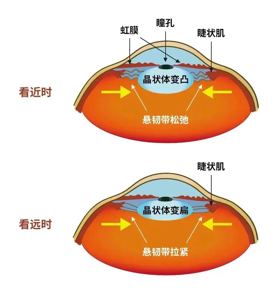 对眼睛而言,缺钙很容易使眼球壁的弹性和表面张力减弱,特别是在长时间