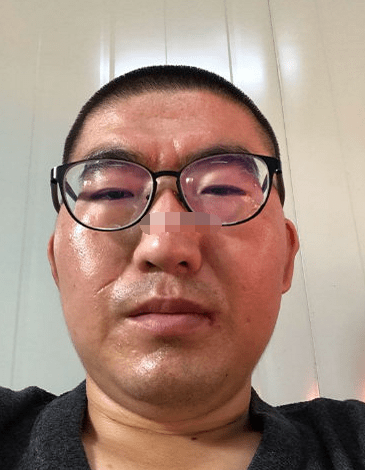 风水命理刘老师/书你印堂处的双雀纹特别的明显,说明你事业心十分强