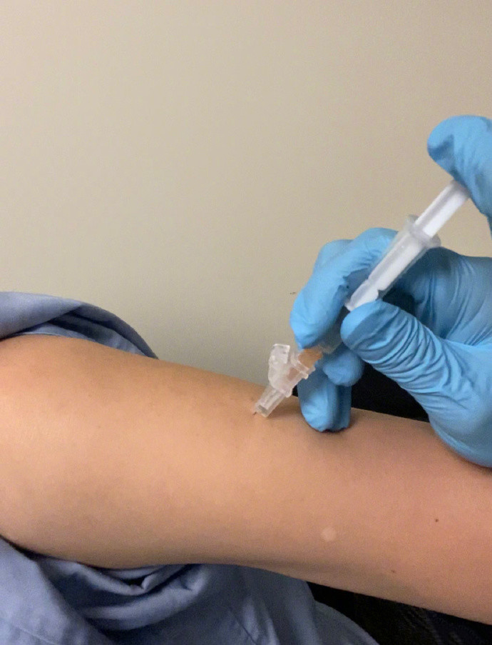 蔡少芬录节目被狗咬伤!已连夜打狂犬疫苗,并晒打针照报平安